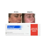 Vitacid gel 0,25mg
