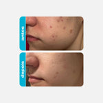 Ácido glicólico + Niacinamida Creme 10% AHA