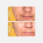 Sérum Antioxidante Clareador - Vitamina C Gold