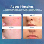 Creme Clareador de Manchas no Rosto e Corpo Clareador Dérmico 60g