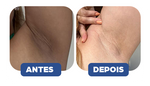 Creme Clareador de Manchas no Rosto e Corpo Clareador Dérmico cicatribem 60g