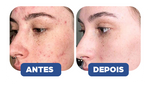 Creme Clareador de Manchas no Rosto e Corpo Clareador Dérmico cicatribem 60g